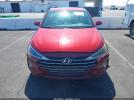 Hyundai ELANTRA Se Image 10